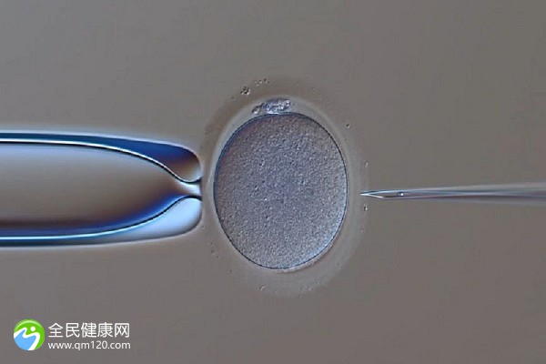 三代试管能否放两个胚胎？
