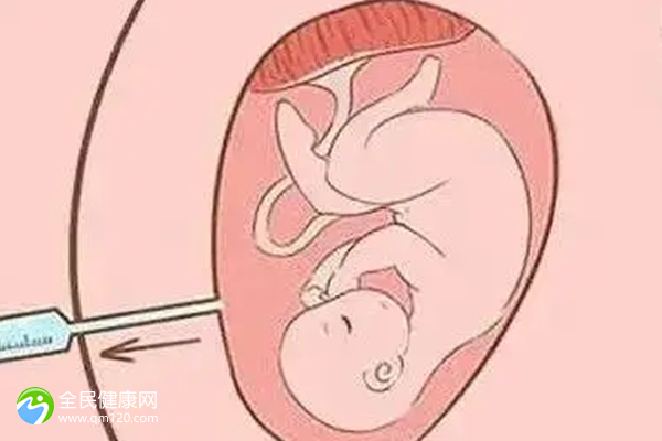唐山中医院试管婴儿费用公开，2024唐山市中医医院试管婴儿费用明细来了