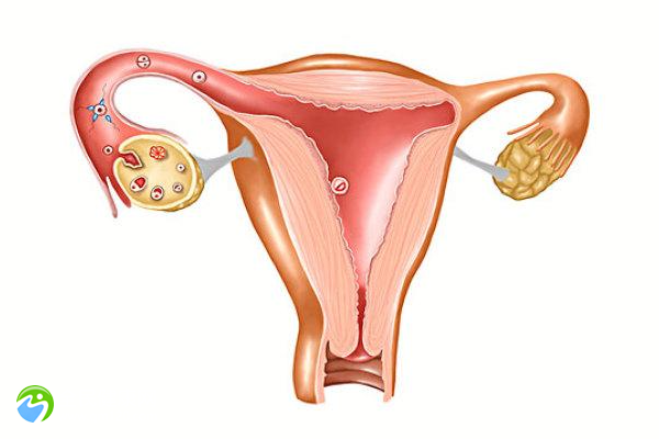 多囊卵巢试管容易流产吗？多囊做试管容易流产吗？