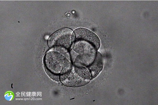 杭州做三代试管的费用多少钱？杭州三代试管婴儿的有哪些医院有？