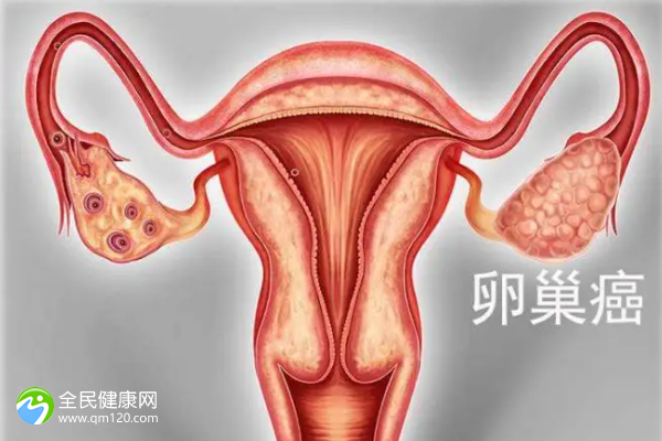 卵巢囊肿对做试管有影响吗？
