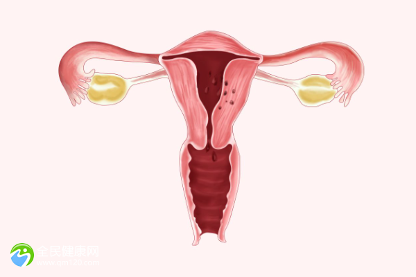 子宫腺肌瘤做试管婴儿成功几率多少？