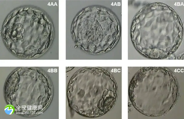 精子很差做试管婴儿成功几率大吗？