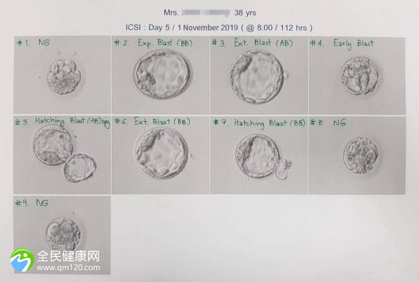 做试管1次不成功，我该怎么办？