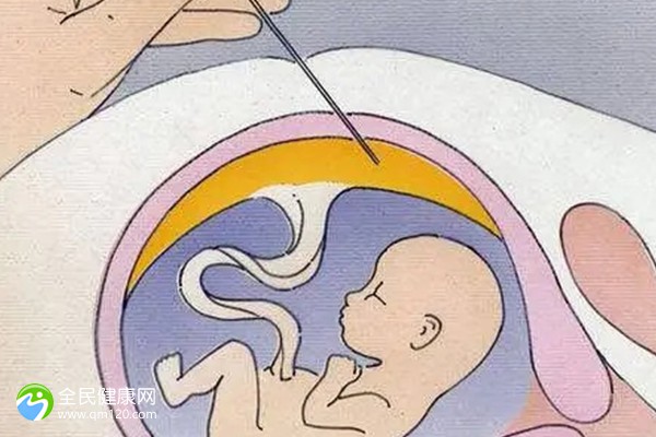 生完孩子多久后才能做试管？生完孩子多久后才能做试管婴儿手术？