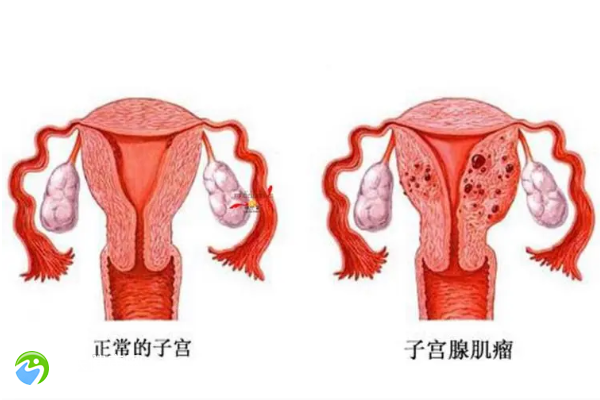 53岁停经了要怎么做试管婴儿？