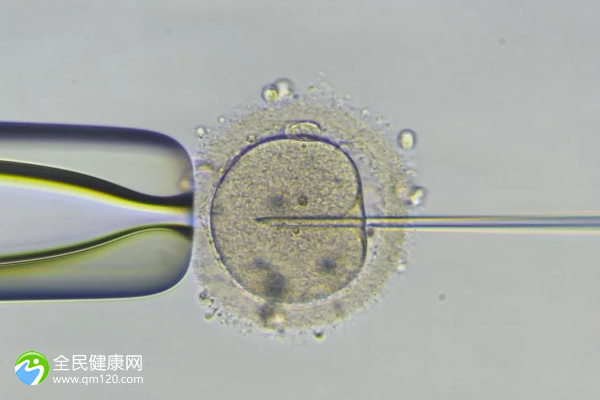 男的有无精试管成功率是多少？