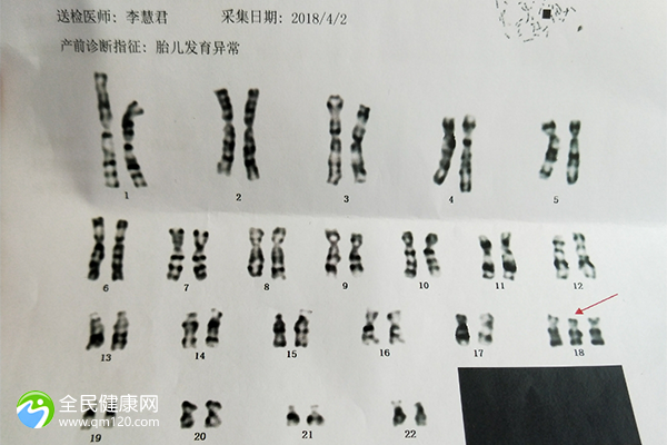 中信湘雅第三代试管可以做双胎吗 中信湘雅三代可以移两个吗