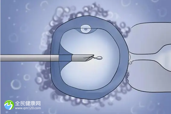 59岁停经了做试管用哪种方案？