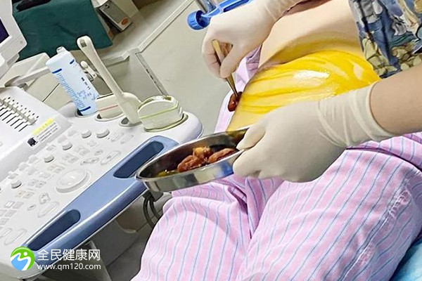 上海瑞金医院一代试管婴儿成功率-上海瑞金医院一代试管婴儿成功率揭秘