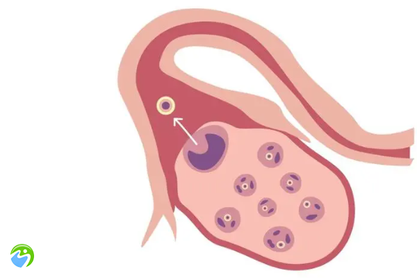 40岁试管一次取几个卵-40岁试管一次取几个卵泡正常