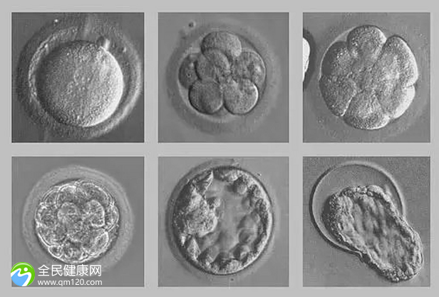 卵泡变成囊肿的原因？ b超有卵泡会不排吗？