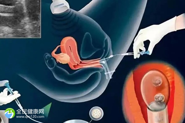 广州正规助孕服务机构排名榜-广州正规助孕服务机构排名