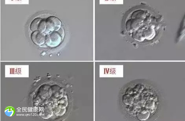 内异症试管失败后能自然受孕吗？