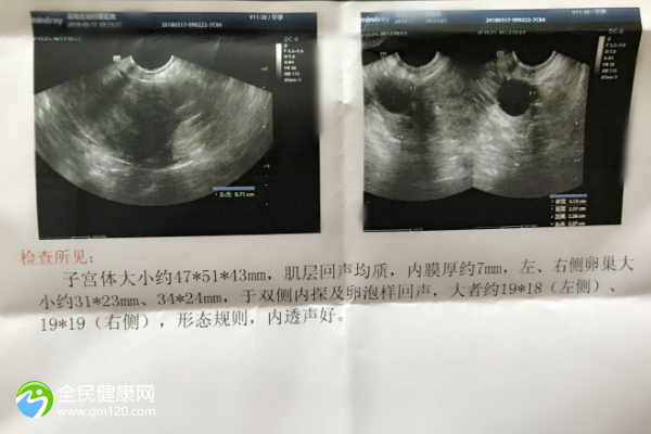 46岁停经后能做试管三代吗？