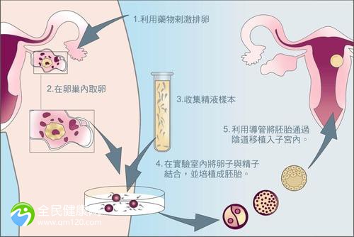 试管卵子取了还会再长吗？试管取完卵还有什么流程？