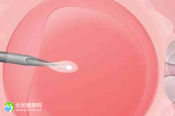 试管婴儿促排卵全是空卵泡的原因是促排方案不对吗？