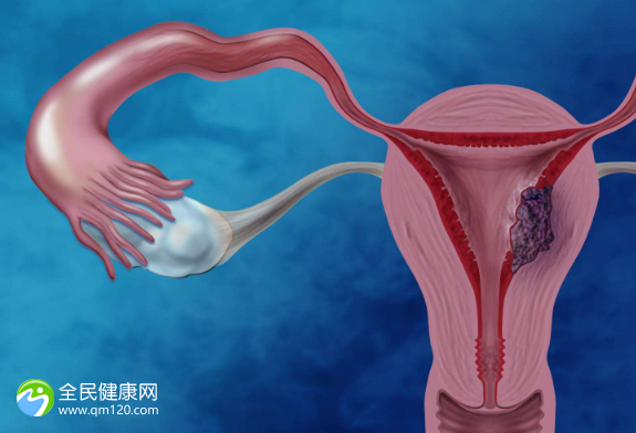 试管促排会引起腺肌症发作吗？试管促排会使子宫肌瘤变大吗？