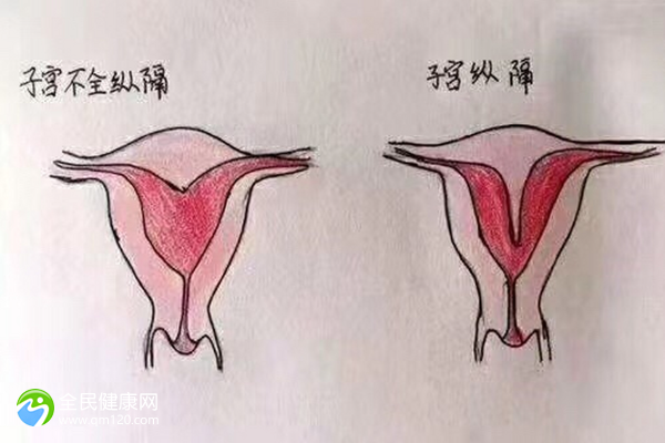 卵巢萎缩做试管的成功率有多少？