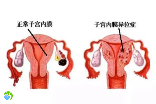 无子宫有卵巢做试管婴儿的成功率高不高？