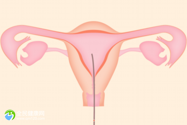 试管5次都不成功，以后会正常怀孕吗？