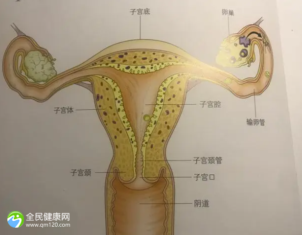 子宫粘连能做试管吗？