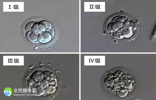 胚胎结合成试管算成功一半了吗？胚胎结合会出血吗？