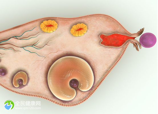 有子宫内膜炎做试管成功的案例