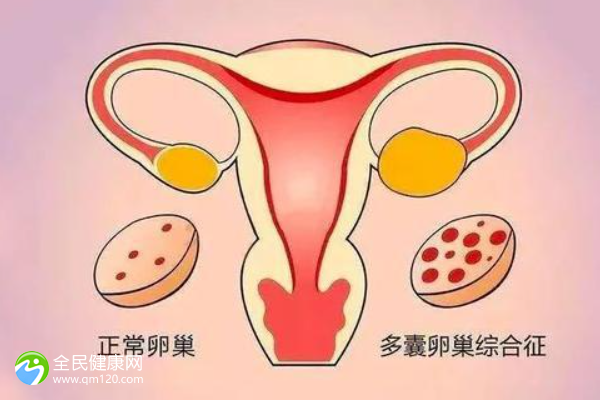 做过试管卵巢会早衰吗_做了试管卵巢会影响吗