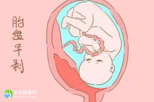 为什么试管怀孕停胎？