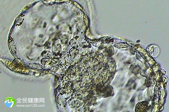 43岁以上三代试管成功率，43岁以上三代试管成功率是多少？