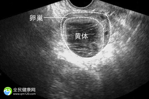 停经多年做试管用什么方案？