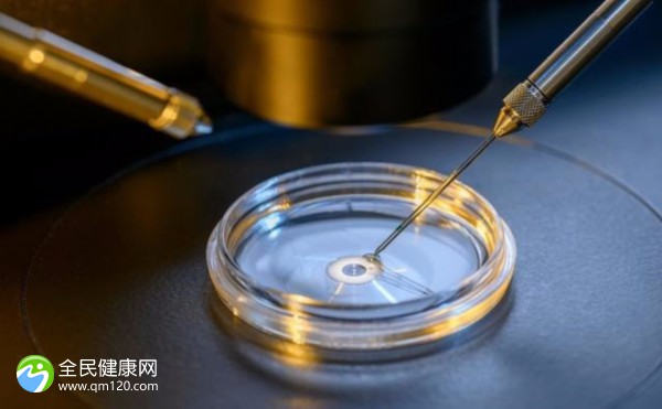 试管四次都没有成功，接下来还要做什么检查吗？