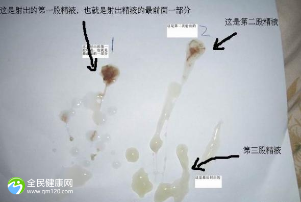 南宁市试管成功率比较高的医院成功率排名，看完这些你就明白了