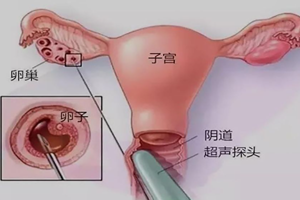 促排卵对女人的伤害大吗